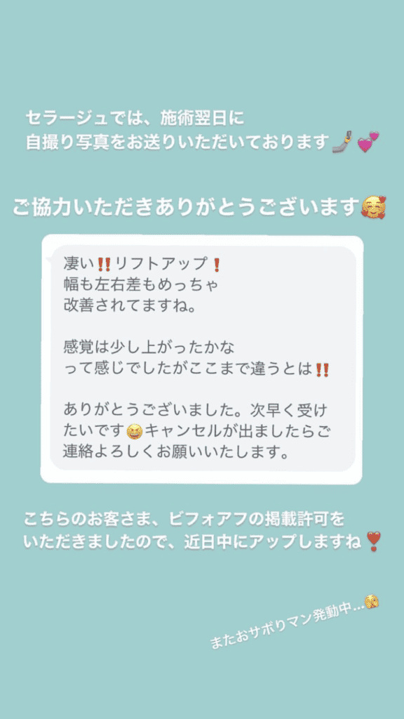 小顔・フェイスライン 左右差