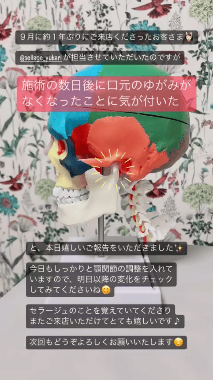 左右差 顎関節・口の開き