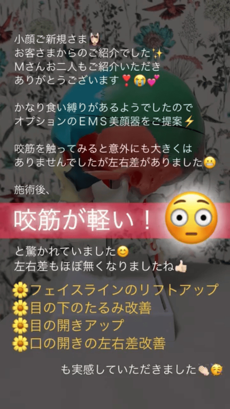 左右差 食いしばり・咬筋 小顔・フェイスライン 目の開き 顎関節・口の開き たるみ