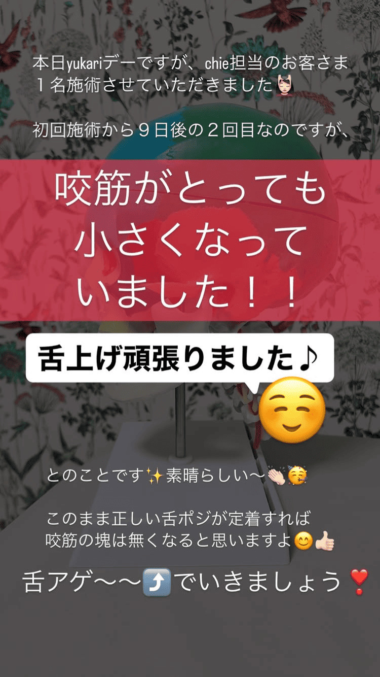 食いしばり・咬筋 舌の位置