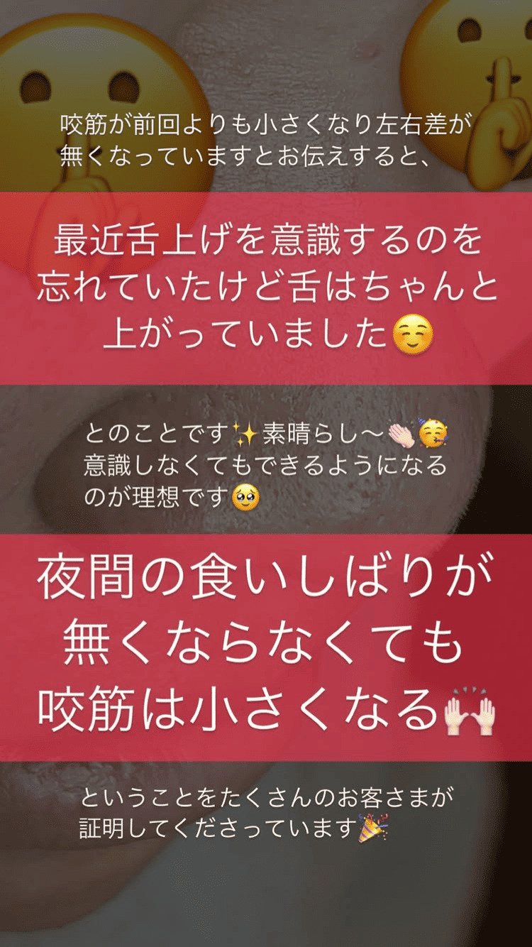 食いしばり・咬筋 舌の位置 左右差