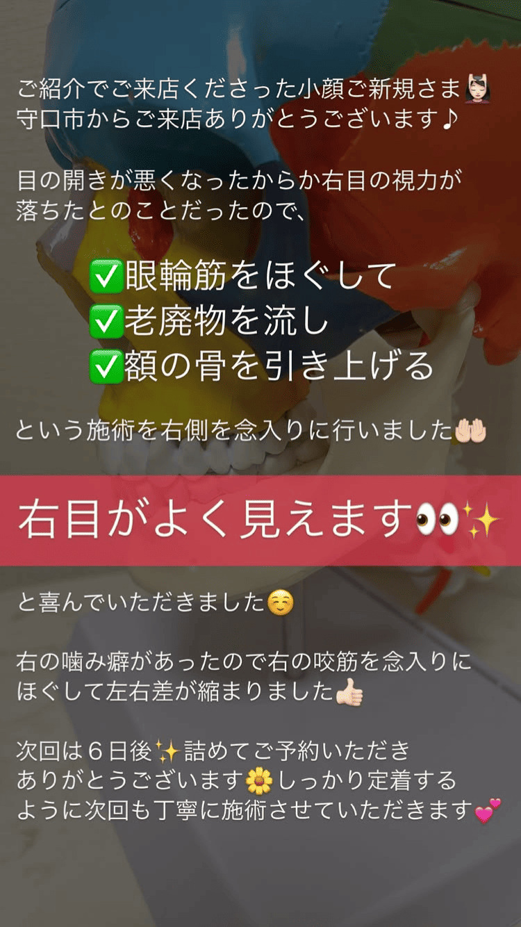 目の開き 左右差 その他