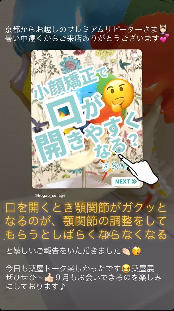 顎関節・口の開き